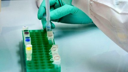 Türk profesörden güzel haber: Sıtma ilacı koronavirüse karşı etkili