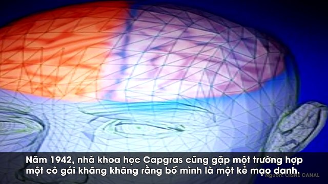 Giải mã tâm lý 9: Hội chứng “những gương mặt quen thuộc” Capgras