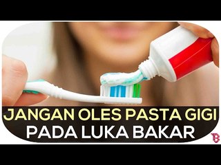 Jangan Oleskan Pasta Gigi Pada Luka Bakar!