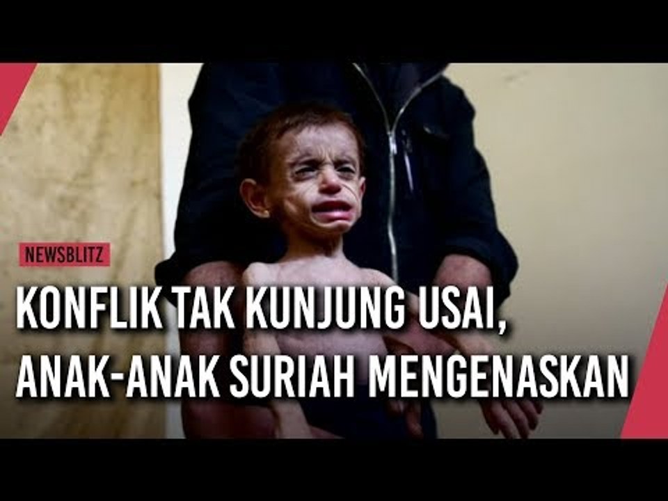 Konflik Tak Kunjung Usai, Anak Anak Suriah Mengenaskan