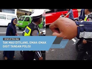 Tak Mau Ditilang, Emak Emak Gigit Tangan Polisi