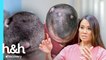 Sete caroços macios brotam na cabeça | Dra. Sandra Lee: A Rainha dos Cravos | Discovery H&H Brasil