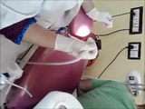 REMOVAL OF DENTAL PLAQUE FULL MOUTH DENTAL SCALING (360 mp4)