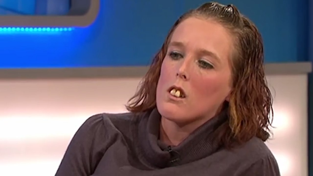 Traumatisée à cause de ses dents, une émission de TV lui sauve la vie