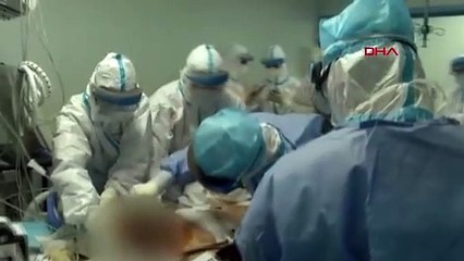 Vuhan'daki doktorlar koronavirüs hastasına çift akciğer nakli gerçekleştirdi