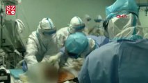 Vuhan'daki doktorlar koronavirüs hastasına çift akciğer nakli gerçekleştirdi