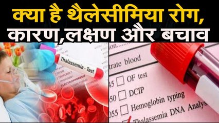 #WorldThalassemiaDay : क्या हैं थैलेसीमिया रोग ? जाने कारण, लक्षण और बचाव