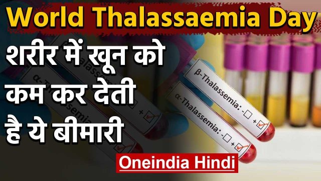 World Thalassaemia Day 2020: शरीर में खून को कम कर देती है ये बीमारी, जा सकती है जान |वनइंडिया हिंदी