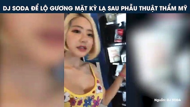 DJ SODA ĐỂ LỘ GƯƠNG MẶT KỲ LẠ SAU PHẪU THUẬT THẨM MỸ