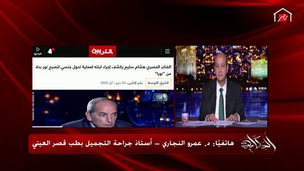 طبيب يرد على سؤال عمرو أديب: كيف يتم تحويل الأنثى بأعضاءها الأنثوية ؟