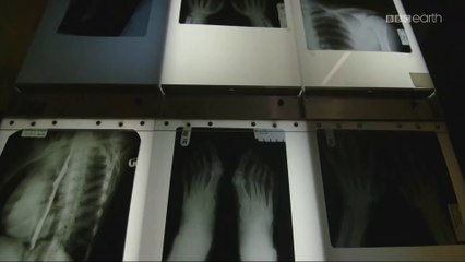 Jak działają nasze kończyny - stopy