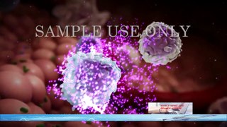 Medical Animation of HIV And AIDS - What is HIV AIDS