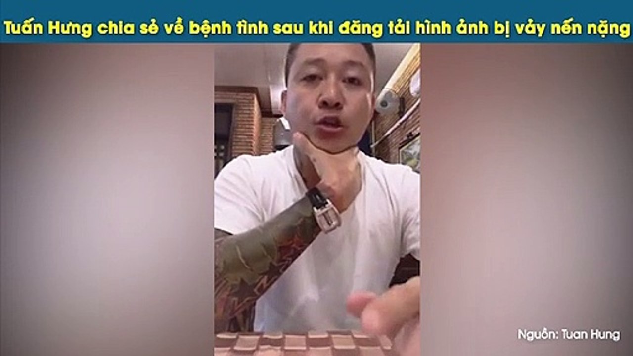 Tuấn Hưng chia sẻ về bệnh tình sau khi đăng tải hình ảnh bị vảy nến nặng
