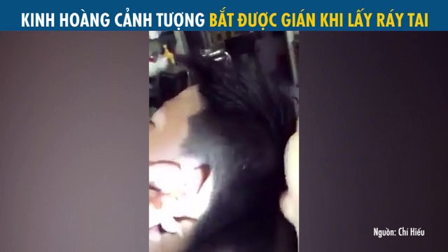 Hãi hùng cảnh tượng nhân viên cắt tóc lôi ra được một chú gián từ tai khách hàng