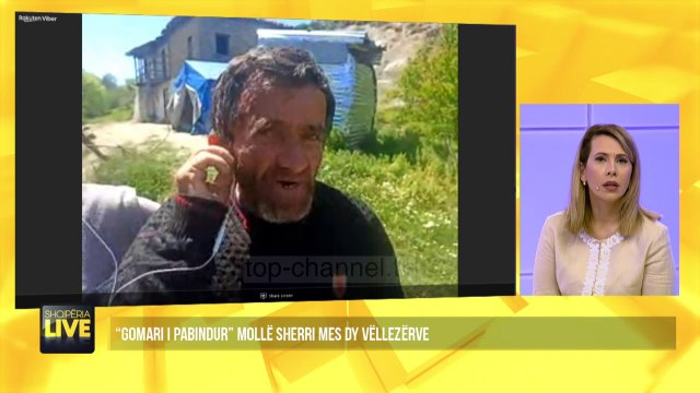 Vëllai e godet me levë, ja shenjat e dhunës në kokë dhe trup - Shqipëria Live, 8 Maj 2020