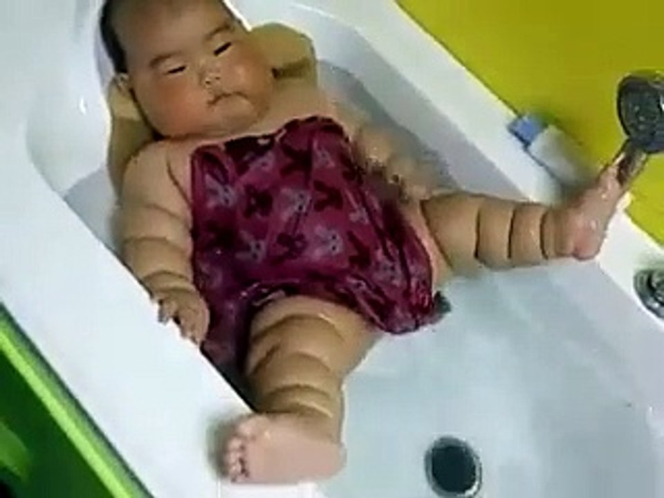 Bất ngờ khi biết căn bệnh nguy hiểm của em bé bụ bẫm nhiều ngấn gây sốt