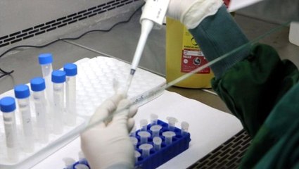 Bilim insanları koronavirüse erkeklerin niçin daha sık yakalandığının olası bir nedenine ulaştı
