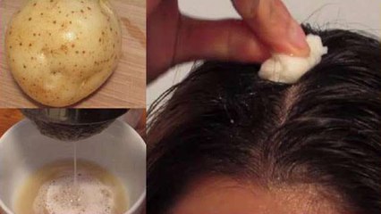 बुढ़ापे तक बाल नहीं होंगे सफेद, करें ये उपाय। Get Rid Of White Hair Naturally। Boldsky