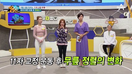 외회전 상태였던 레이디 제인의 무릎... 운동 후 상태는?