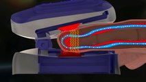 Videografik: Pulsoximeter - Sauerstoffwächter für Lungen-Patienten