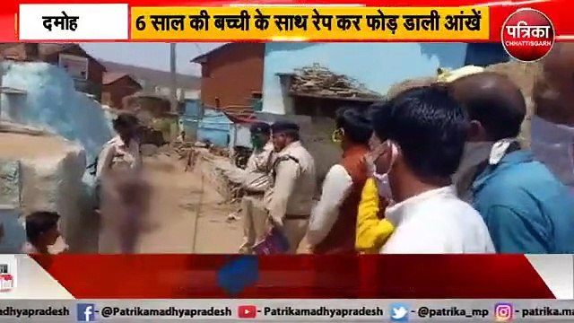 6 साल की बच्ची के साथ दुष्कर्म कर फोड़ दी आंखें, 6-year-old girl raped in Damoh and broke eyes