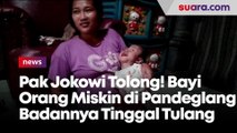 Pak Jokowi Tolong! Bayi Orang Miskin di Pandeglang Badannya Tinggal Tulang