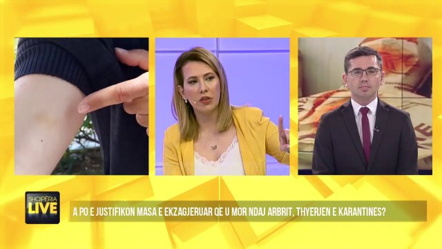 Dentisti tregon shenjat e dhunës, që i janë shkaktuar nga policia - Shqipëria Live, 5 Maj 2020