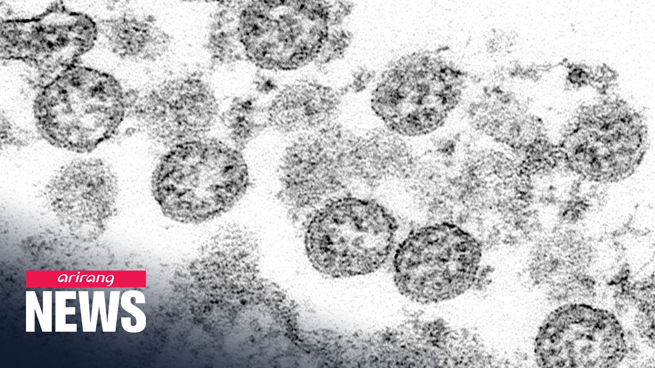 Potential spread of mysterious illness linked to COVID-19 moving through U.S