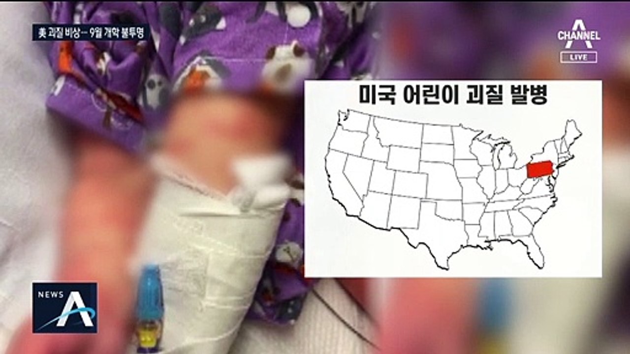 美 ‘어린이 괴질’ 확산에 비상…가을 개학 가능할까