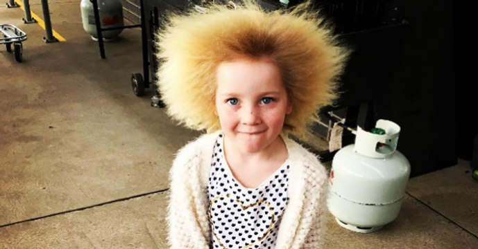 Cette fillette atteinte du syndrome des cheveux incoiffables ressemble à une poupée troll