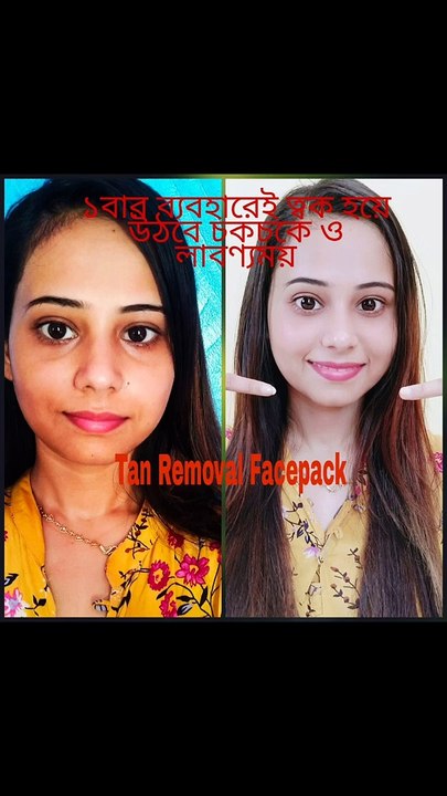 How to Remove Sun Tan, Suntan Removing At Home Immediately, SunTan Removal from Face Home Remedies