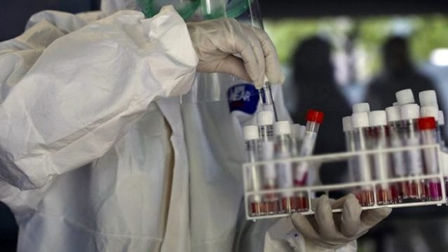 Son Dakika: Türkiye'de koronavirüs aşısı için anti serum çalışmaları başladı