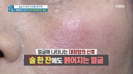 무심코 마신 술 한 잔에 붉어진 얼굴! OOO의 신호를 의심하라!