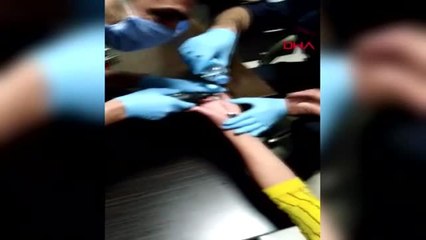 Parmağında sıkışan yüzüğü itfaiye çıkardı