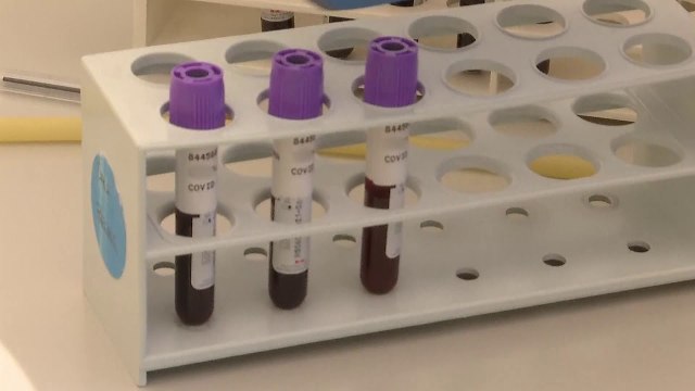 За корона тест на заболените од сезонски грип потребно многу време и пари