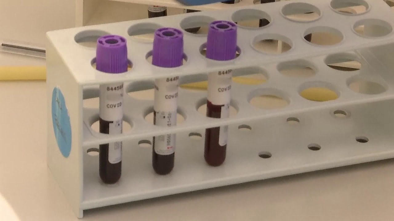 За корона тест на заболените од сезонски грип потребно многу време и пари