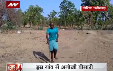 Unusual disease engulfs Koriya village in Chattisgarh