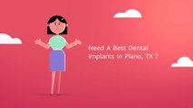 Whitmore Best Dental Implants in Plano TX | 972-985-1580