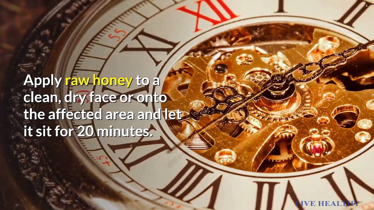 BLACKHEADS REMOVAL।। HOW TO REMOVE BLACKHEADS / WHITEHEADS FROM FACE AND NOSE NATURALLY AT HOME