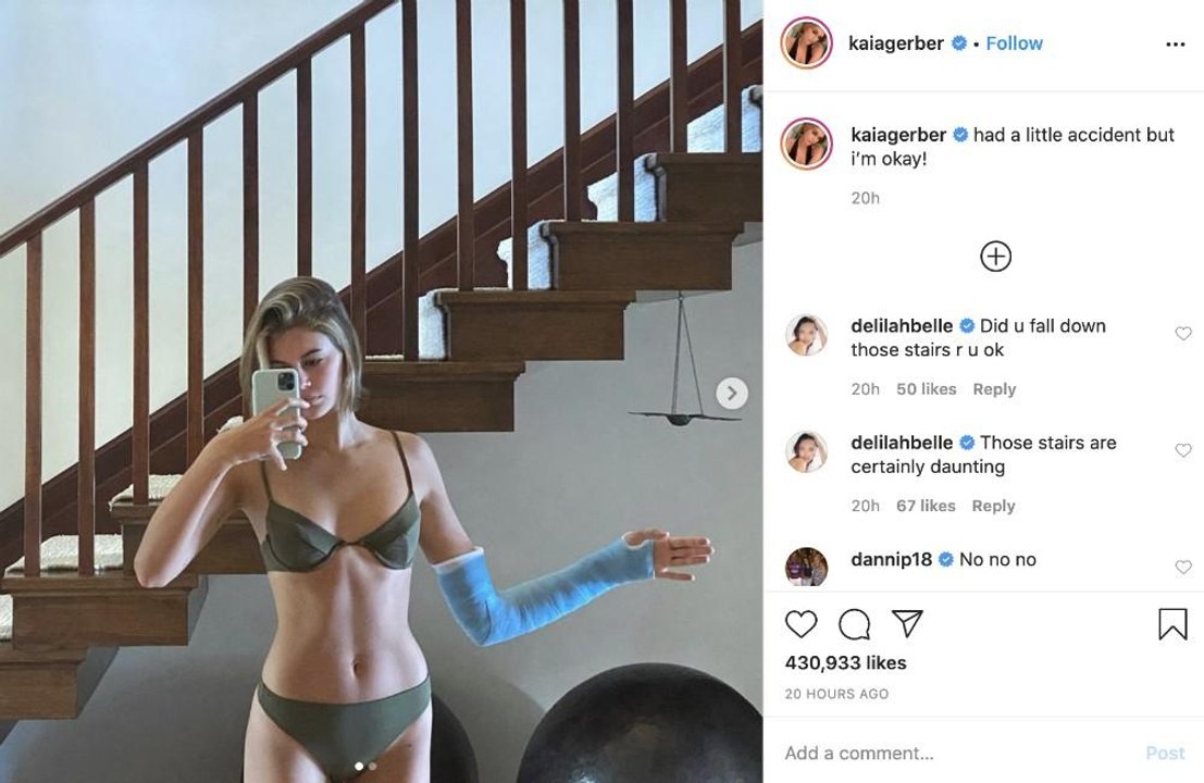 Kaia Gerber: Handgelenk gebrochen