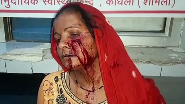 शामली: दो पक्षों में मारपीट, दो महिला, तीन पुरुष घायल, पुलिस जांच में जुटी