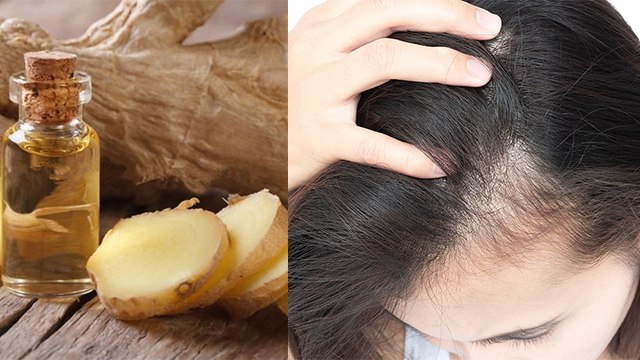Ginger oil से झड़ते हुए बालों को दोबारा कैसे उगाए | अदरक का तेल बनाने की विधि | Boldsky