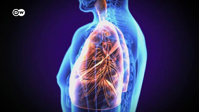 Autopsies reveal- Coronavirus is more than a lung infection - COVID-19 Special