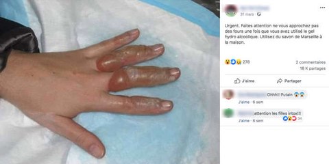 Attention à ces photos détournées illustrant les dangers du gel hydroalcoolique