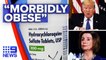 Coronavirus- Trump called “morbidly obese” over treatment debate