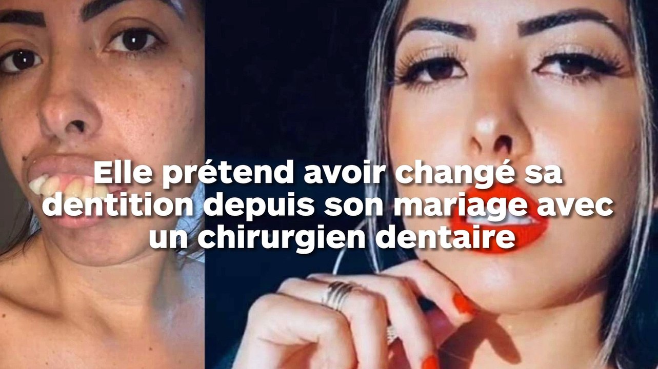 Ses dents sont-elles si parfaites depuis qu'elle a épousé un chirurgien ?