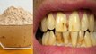 दांतो में लगे कीड़े, पायरिया और मुंह से आने वाली बदबू से मिलेगा आराम, बस करें ये काम | Boldsky