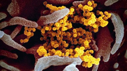 [현장영상] "이태원 클럽 관련 초기 환자 14명 바이러스 G형" / YTN