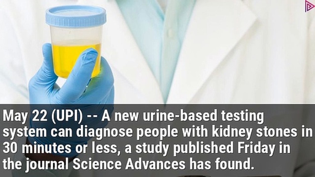 New urine-based kidney stone test delivers results in 30 minutes