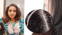 Dr. Falkia Samar से जानें कैसे पाएं Dandruff से हमेशा के लिए छुटकारा | Dandruff Remedies | Boldsky